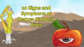 Herpes Simplex Virus 10 Signs and Symptoms [upl. by Negiam62]