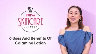 6 Uses And Benefits Of Calamine Lotion  POPxo Skincare Secrets [upl. by Harbert]