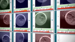 EmbryoScope® Timelapse System [upl. by Mahalia]