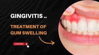 Gingivitis Complete Treatment  Swelling in Gums ⚕️⚕️ [upl. by Penney]