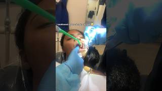 Pinched nerve after my wisdom tooth extraction [upl. by Issim]