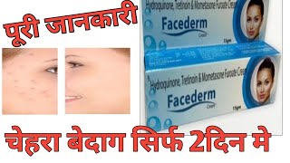 Hydroquinone Tretinoin amp Mometasone Furoate Cream Review by Guru Kirpa Clinic [upl. by Eintihw22]