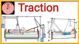 TractionDefinitionTypes of tractionIndicationsContraindicationsPrecautionsPurposeTraction [upl. by Attenna89]