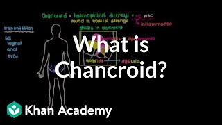 What is chancroid  Infectious diseases  NCLEXRN  Khan Academy [upl. by Tterej]