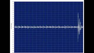 Transformer with tracking in time series view [upl. by Nairdna]