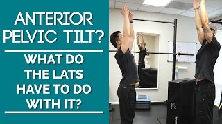 Tight Lats Anterior Pelvic Tilt Stretches To Fix The Anterior Pelvic Tilt [upl. by Raynah]