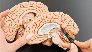 Brain Anatomy Cross Section Structures  MADE EASY  Part 3 of 5 [upl. by Marlette646]