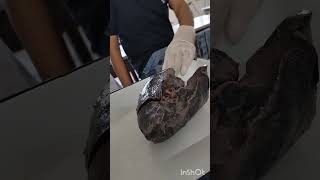 Lungs Dissection Anatomy Lab Msm Khanpurkalan Bams 1st proff Ayurveda [upl. by Antoni52]