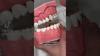 IRRIGADOR DENTAL [upl. by Gnahc]