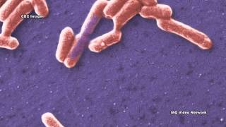 CarbapenemResistant Enterobacteriaceae CRE [upl. by Pacorro323]