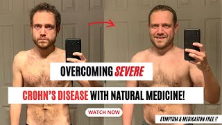 Reversing Severe Crohns Disease with Natural Medicine Watch How [upl. by Watson209]