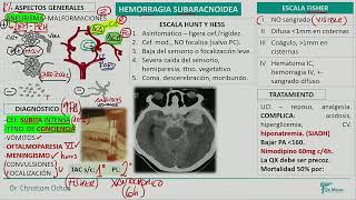 Neurología  Hemorragia subaracnoidea [upl. by Arimlede857]