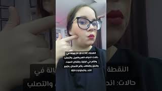 النقطة 6E JIA CHE فعالة في الطب التقليدي الصيني [upl. by Tem]