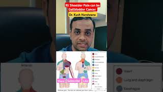 Why This Shoulder Pain Could Be Cancer ytshorts shorts [upl. by Noteek]