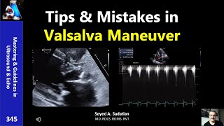 Tips amp Mistakes in Valsalva Maneuver [upl. by Demy]