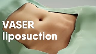 VASER liposuction is also called ultrasoundassisted liposuction VASER lipo or LipoSculpting [upl. by Ahsiek]