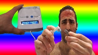 How to use Derminator 2  Everything you need to know regards to microneedling and hair loss [upl. by Heber]