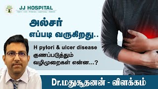 அல்சர் எப்படி வருகிறது H pylori and Ulcer disease குணப்படுத்தும் வழிமுறைகள் Dr Madhusudhanan J [upl. by Asiluj]