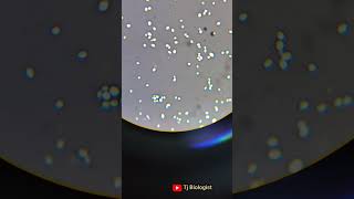 Negative staining  capsulated organism  Microbiology  Chennai clinical microbiologyTj Biologist [upl. by Atinuj]