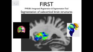 8 Segmentation Subcortical Brain Structures and FIRST Struc E2 [upl. by Groos]