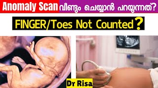 Anomaly Scan Malayalam  5th Month Pregnancy Scan [upl. by Postman]