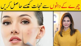 How To Remove Pimples  Acne Treatment  Chehre Ke Dano Asan Ka Ilaj  Ayesha Nasir [upl. by Rai]