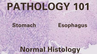 Normal Histology of Esophagus and Stomach  Pathology 101 GI Pathology [upl. by Nerrat]