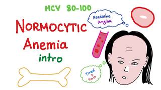 Normocytic Anemia Intro [upl. by Dlarej]