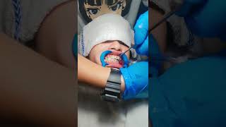 Braces Adjustment trending satisfying braces bracesjourney bracestreatment orthodontics fyp [upl. by Idnal]