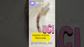 🎯OBSTRUCCIÓN CÁNULA de TRAQUEOSTOMÍA 👉VÍA AÉREA OBSTRUIDA [upl. by Buerger]