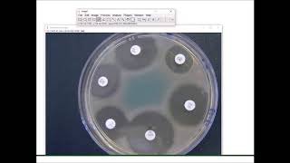 Traitement dun antibiogramme par ImageJ [upl. by Adni]