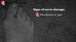 How to Check Your Feet For Signs of Nerve Damage [upl. by Oswald]