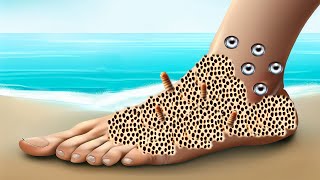 ASMR Animation Foot Treatment  Maggots Removal [upl. by Porett]