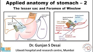 Lesser sac and foramen of Winslow  Applied anatomy of stomach part 2 [upl. by Hanson]