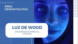 Diagnóstico de quotVITÍLIGOquot con Luz de Wood  Dermaperú [upl. by Roda]