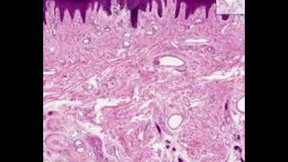 Shotgun Histology Thick Skin [upl. by Lida]