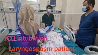 ICU Intubation how to insert ETT in Laryngospasm patient [upl. by Aicnelev]