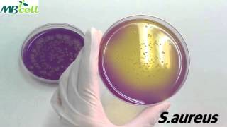 Dextrose Tryptone Agar [upl. by Stephania755]