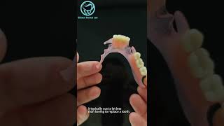 valplast partial denture dentallab valplast partialdenture [upl. by Glennis523]