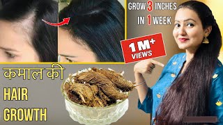 30 Days Extreme Hair Growth Challenge  कितने भी झड़ चुके हों बाल इस रेमेडी से होगी कमाल की Growth [upl. by Sianna]