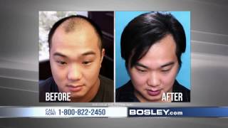 Tired of Losing Your Hair  Bosley Commercial [upl. by Bernie]