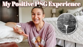 My Positive HSG Experience  The Procedure Start to Finish  2 Years Infertility  Fertility Journey [upl. by Llenrep]