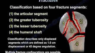 Proximal Humerus Fractures classification  Everything You Need To Know  Dr Nabil Ebraheim [upl. by Quintana]