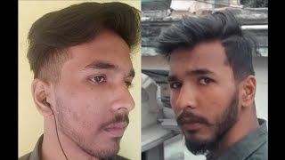 how to grow beard with minoxidil 👤 how to grow beard in teenage how to grow patchy beard minoxidil [upl. by Iliram]