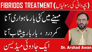 Fibroids CausesSymptoms And Treatment In Urdu [upl. by Goraud]