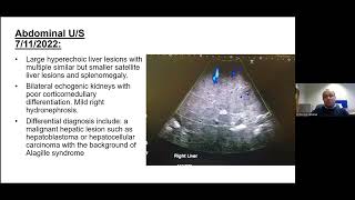 Alagille syndrome and genetic diagnosis of cholestasis in infants  Dr E Elkhatiali [upl. by Cacilie]