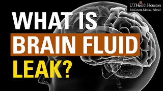 What is Brain Fluid Leak Symptoms and Treatment for CSF Leak [upl. by Airdnaxela]