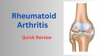 Rheumatoid Arthritis Diagnostic Criteria amp Management  Part2  Chapter11 [upl. by Nannette]