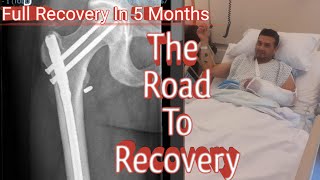 Full Recovery In 5 Months Femur Fracture Recovery The Road To Recovery fahadinfo124 [upl. by Haukom]