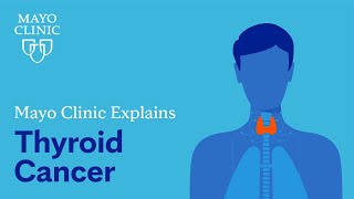 Mayo Clinic explains thyroid cancer [upl. by Eliga]